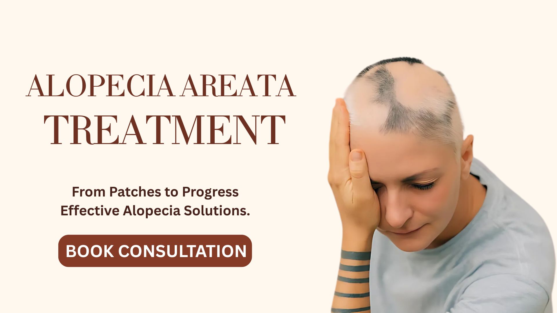 Alopecia areata treatment in pune