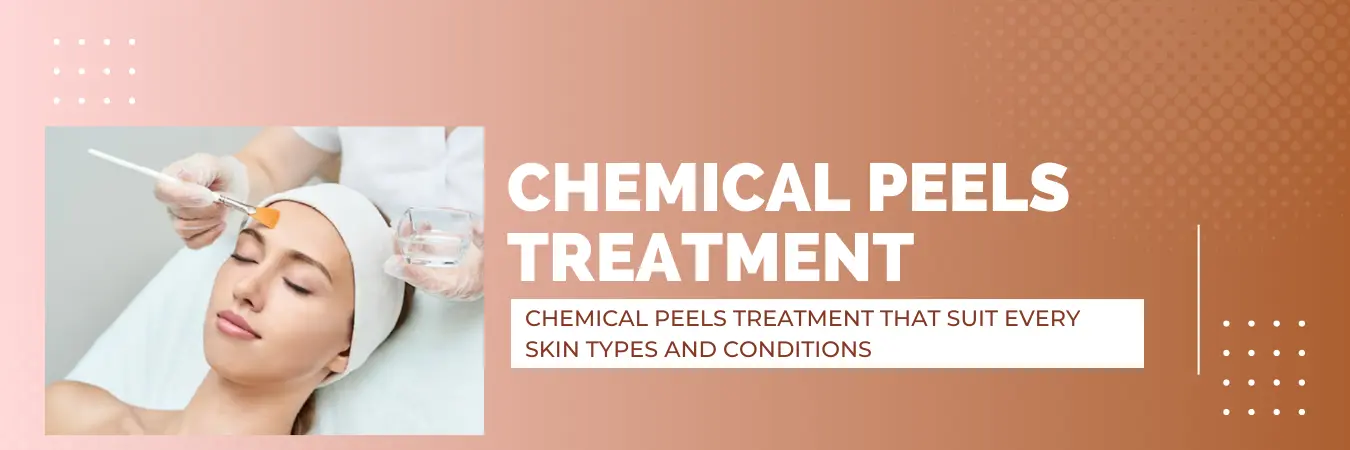 Chemical Peel treatment