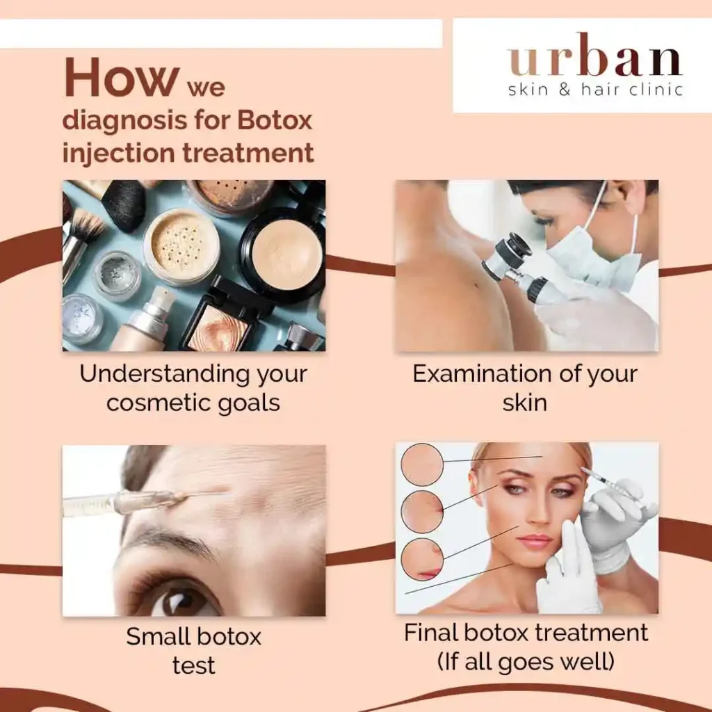 How we diagnosis for Botox injection treatment