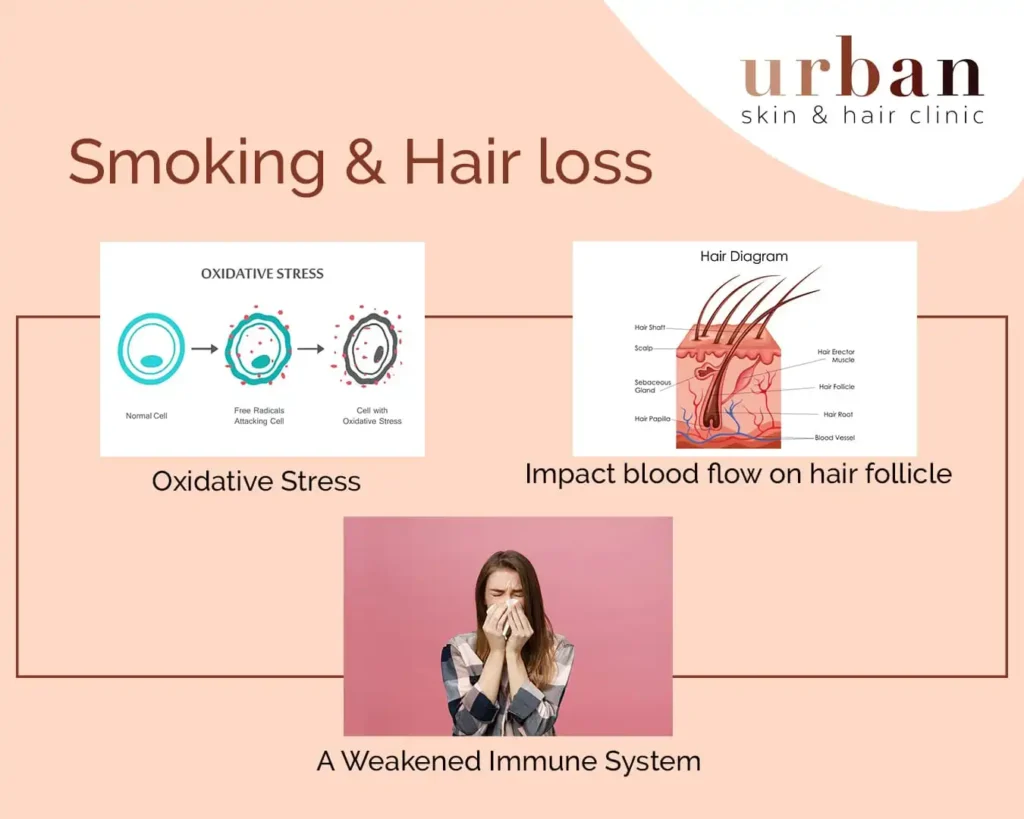 Smoking and Hair loss