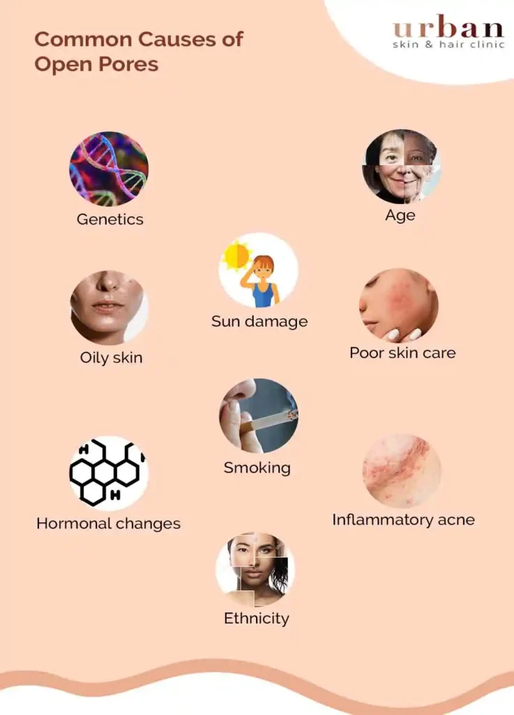 Common Causes of Open Pores