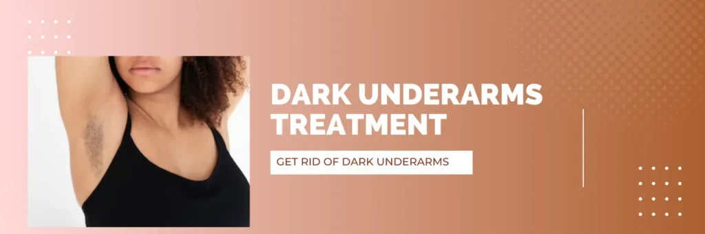 Dark Underarms treatment