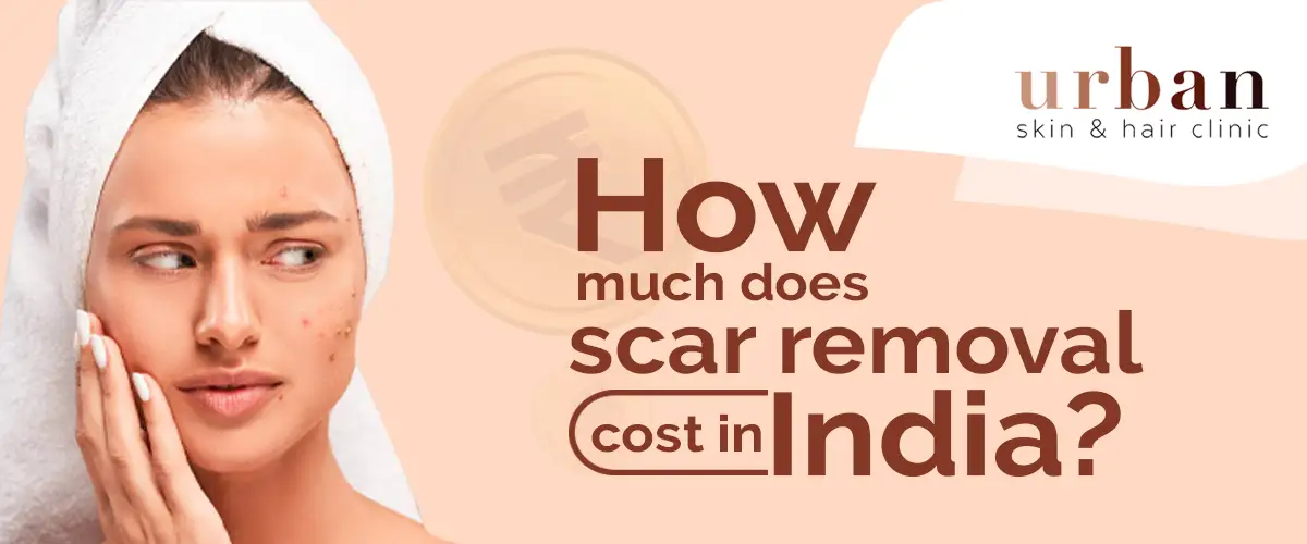 How much does scar removal cost in India? [Reveled] USHC