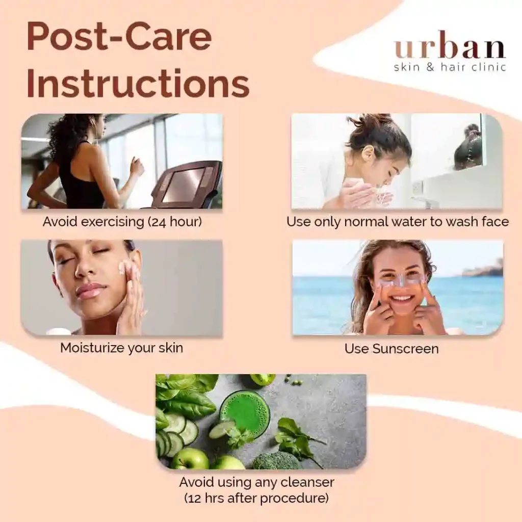 Post-Care Instructions