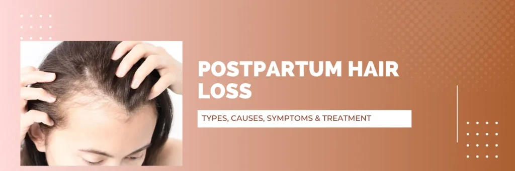 Postpartum Hair Loss Types, Causes, Symptoms & Treatment