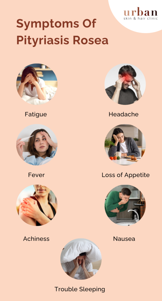 Symptoms Of Pityriasis Rosea