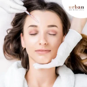 What is face PRP treatment