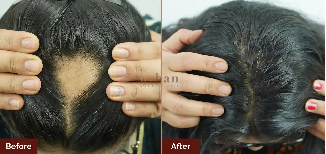Homes 21 female hair loss treatment