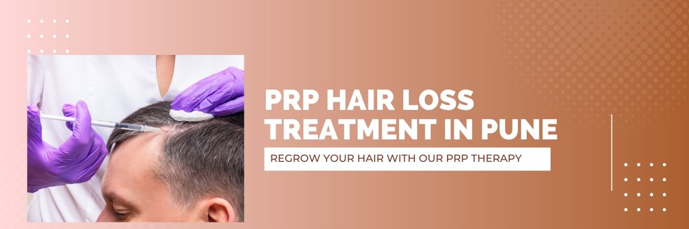 PRP hair loss treatment in pune