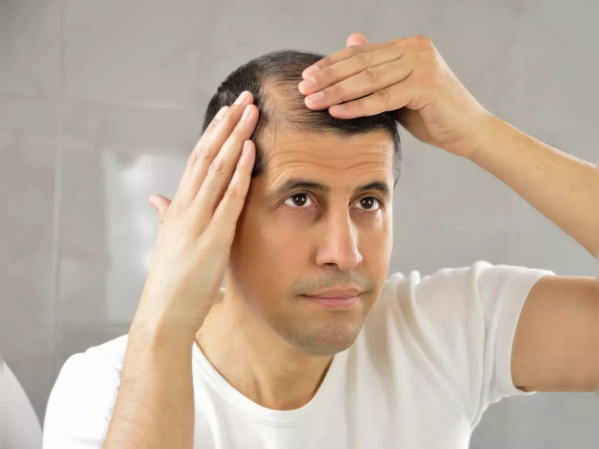 Homes 6 Hair Fall in Mens