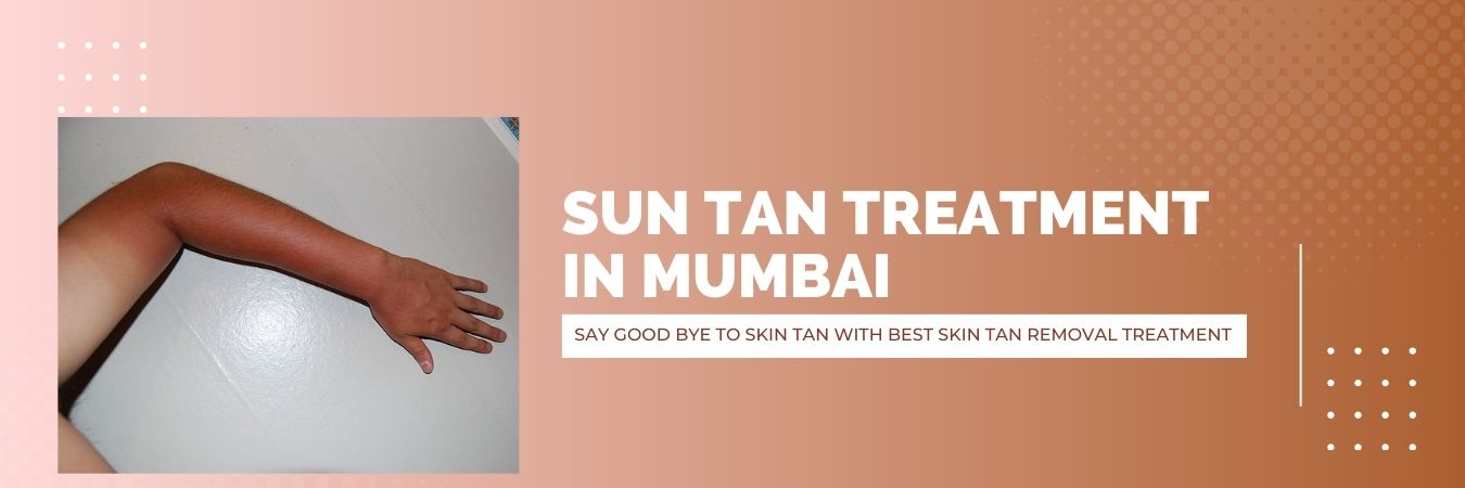 Sun Tan Treatment in Mumbai