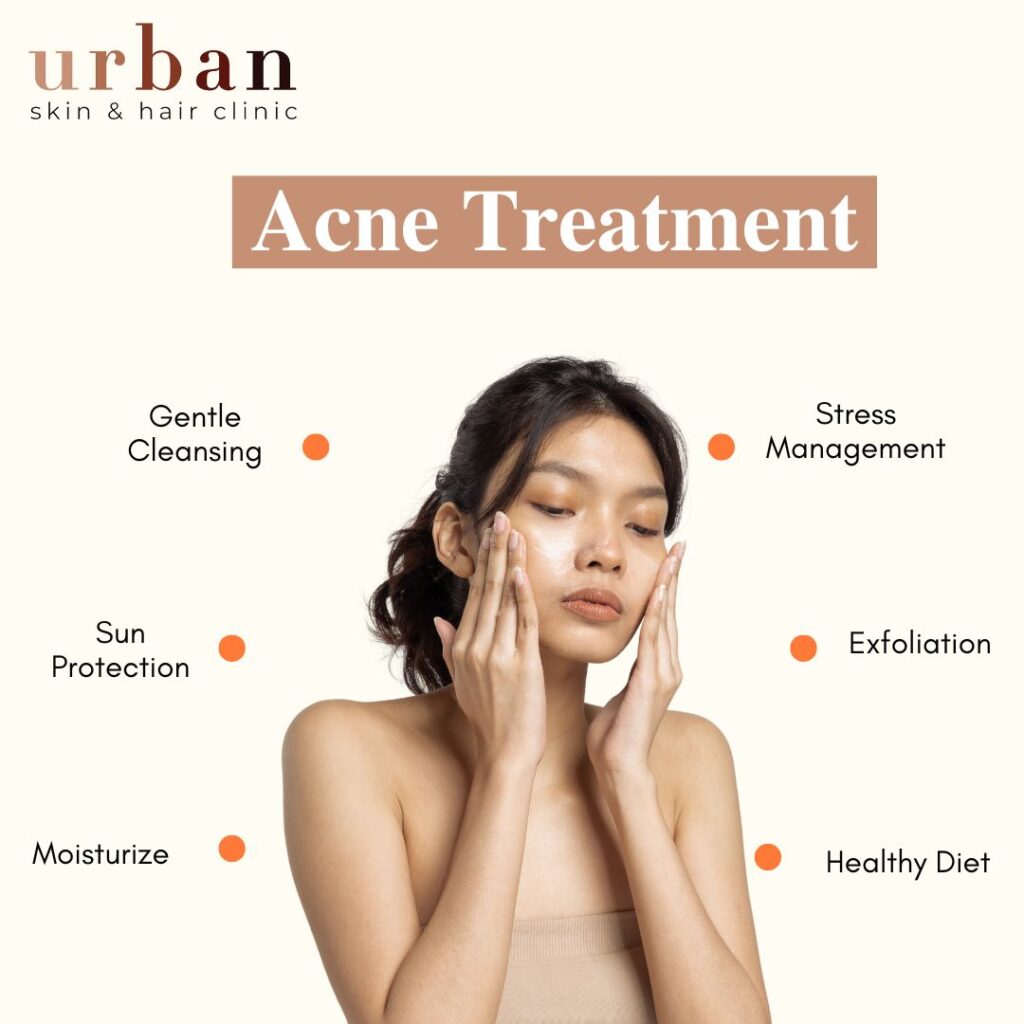 Benefits of Acne Treatment