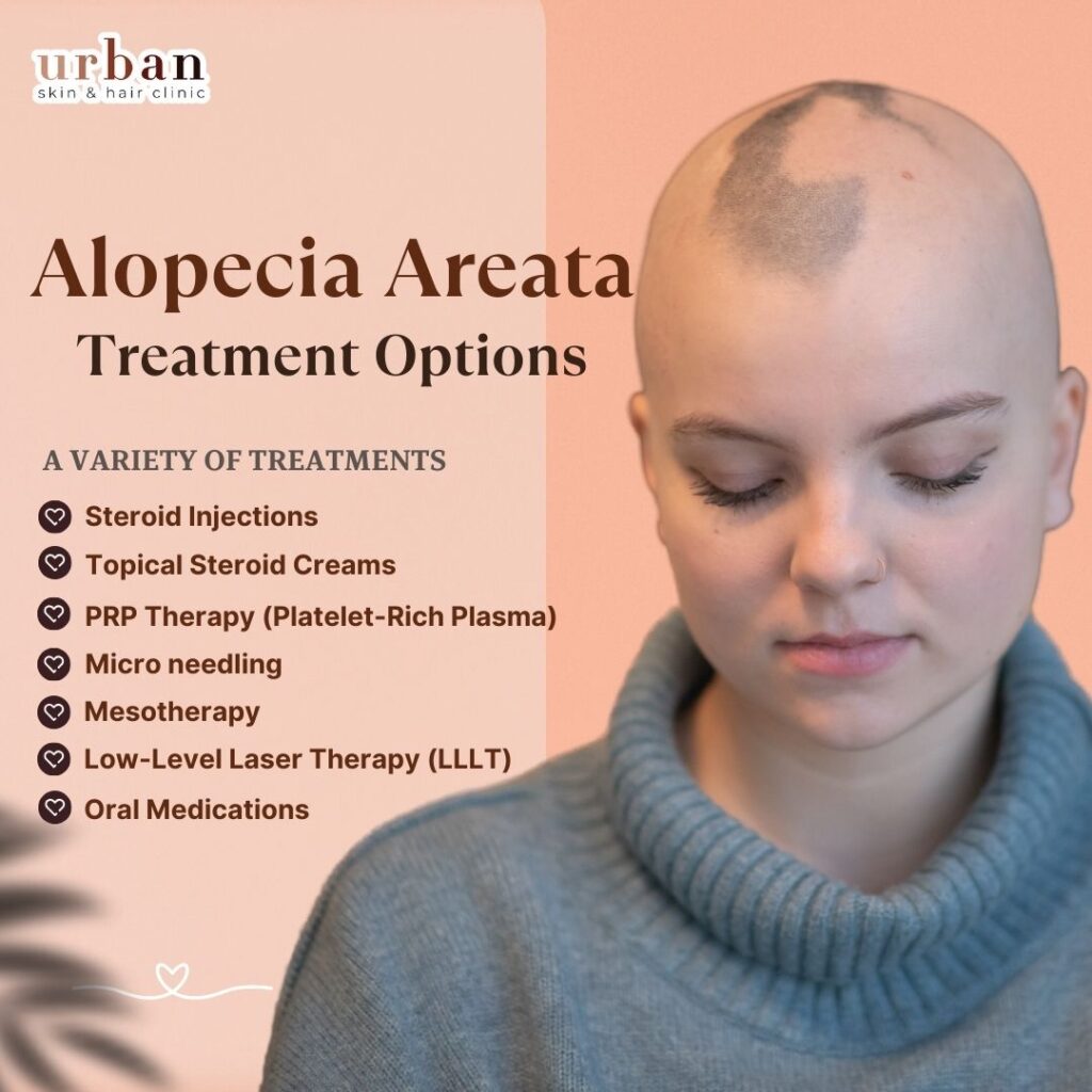 Alopecia Treatment options