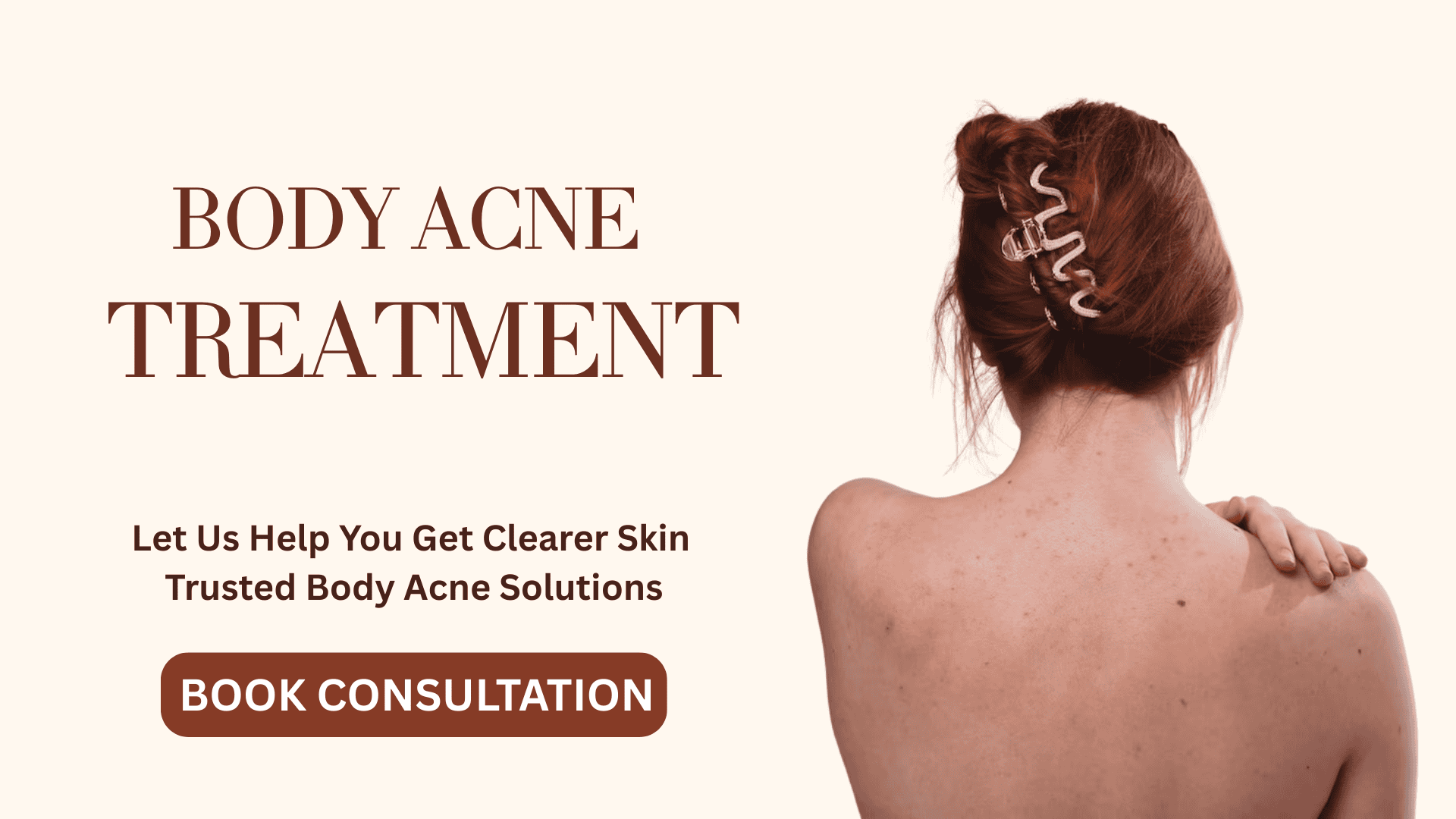Body Acne treatment in pune