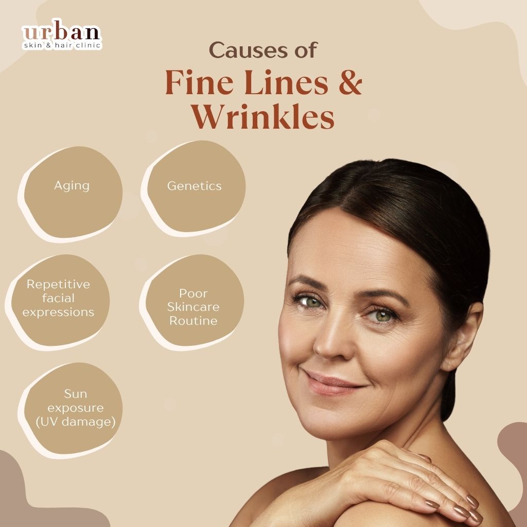 Causes of Fine Lines & Wrinkles