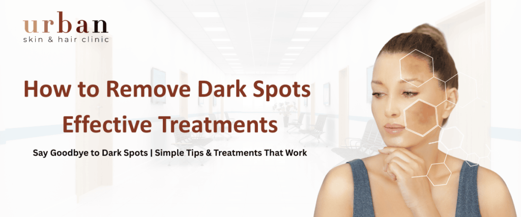 Dark Spot Treatment