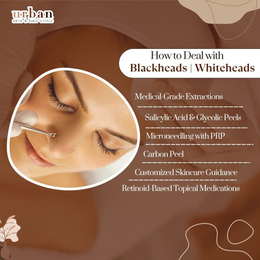 Treatment Options for blackheads in pune