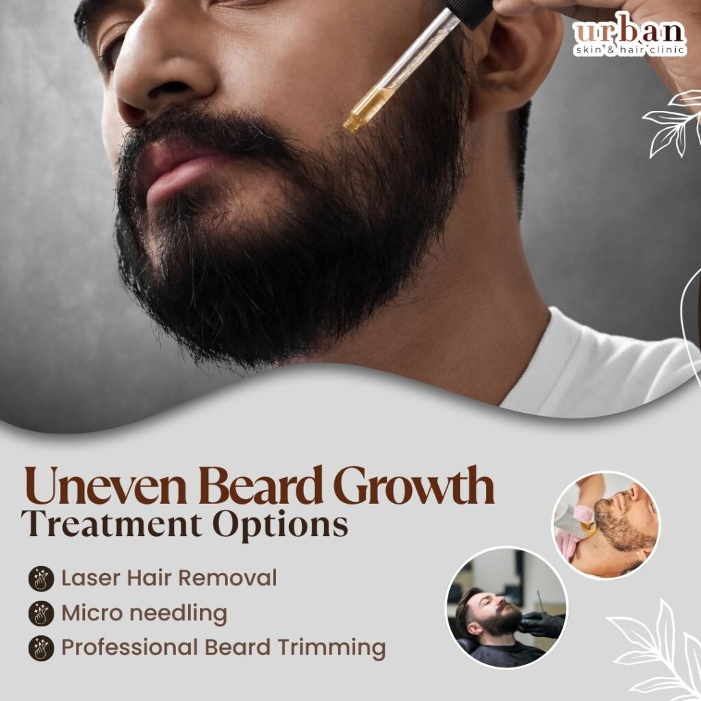 Beard Growth Treatment