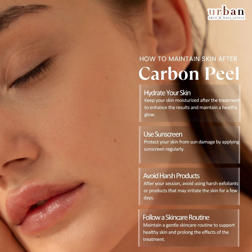 Carbon Peel Treatment