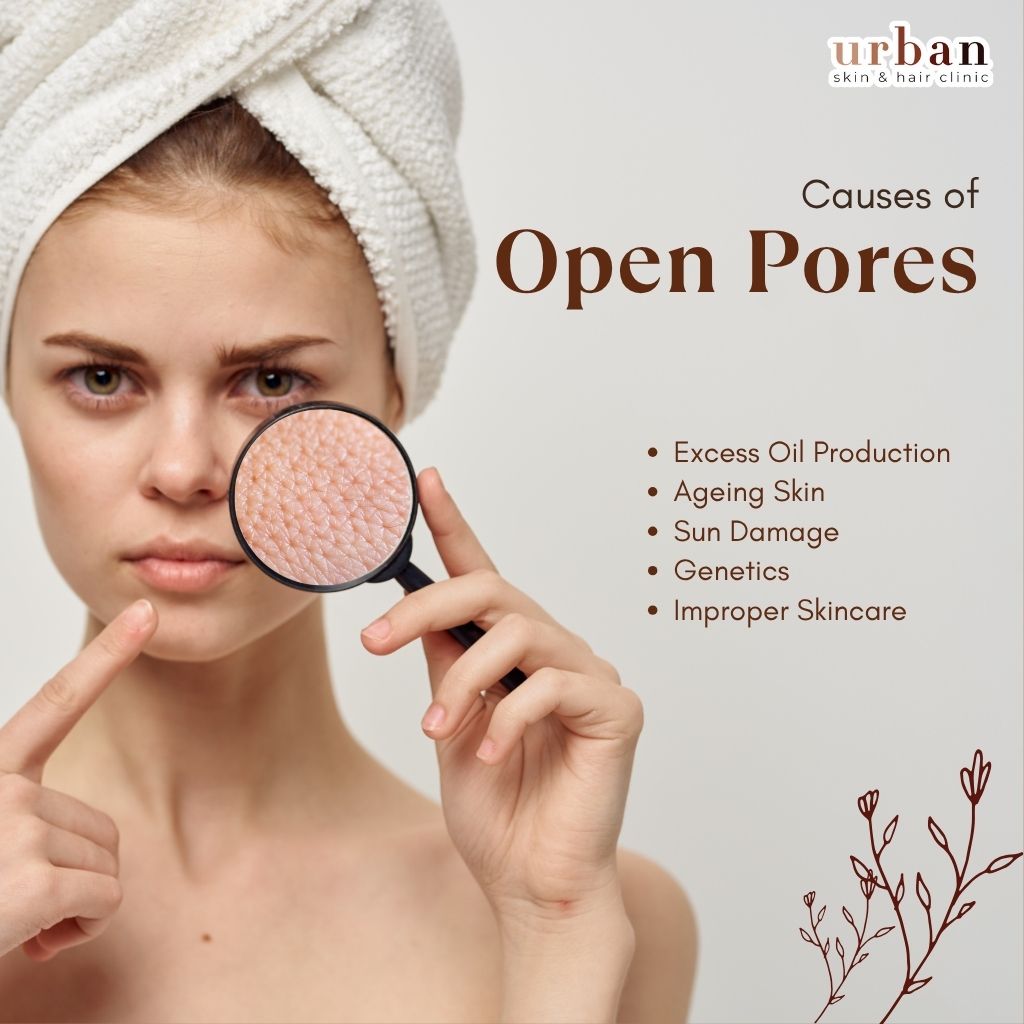 Couse of Open Pores