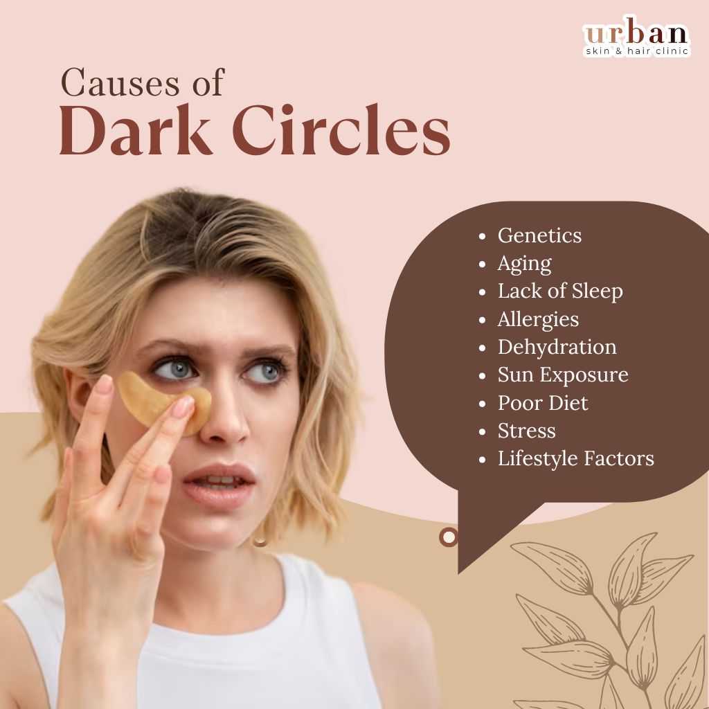 Causes of dark circles