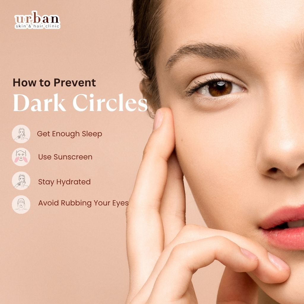How to prevent dark circles