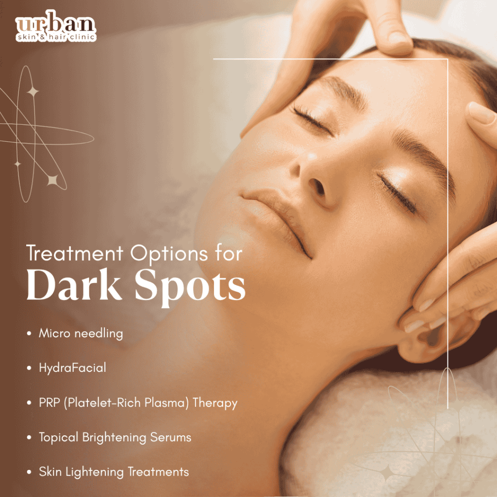 Treatment options for dark spots