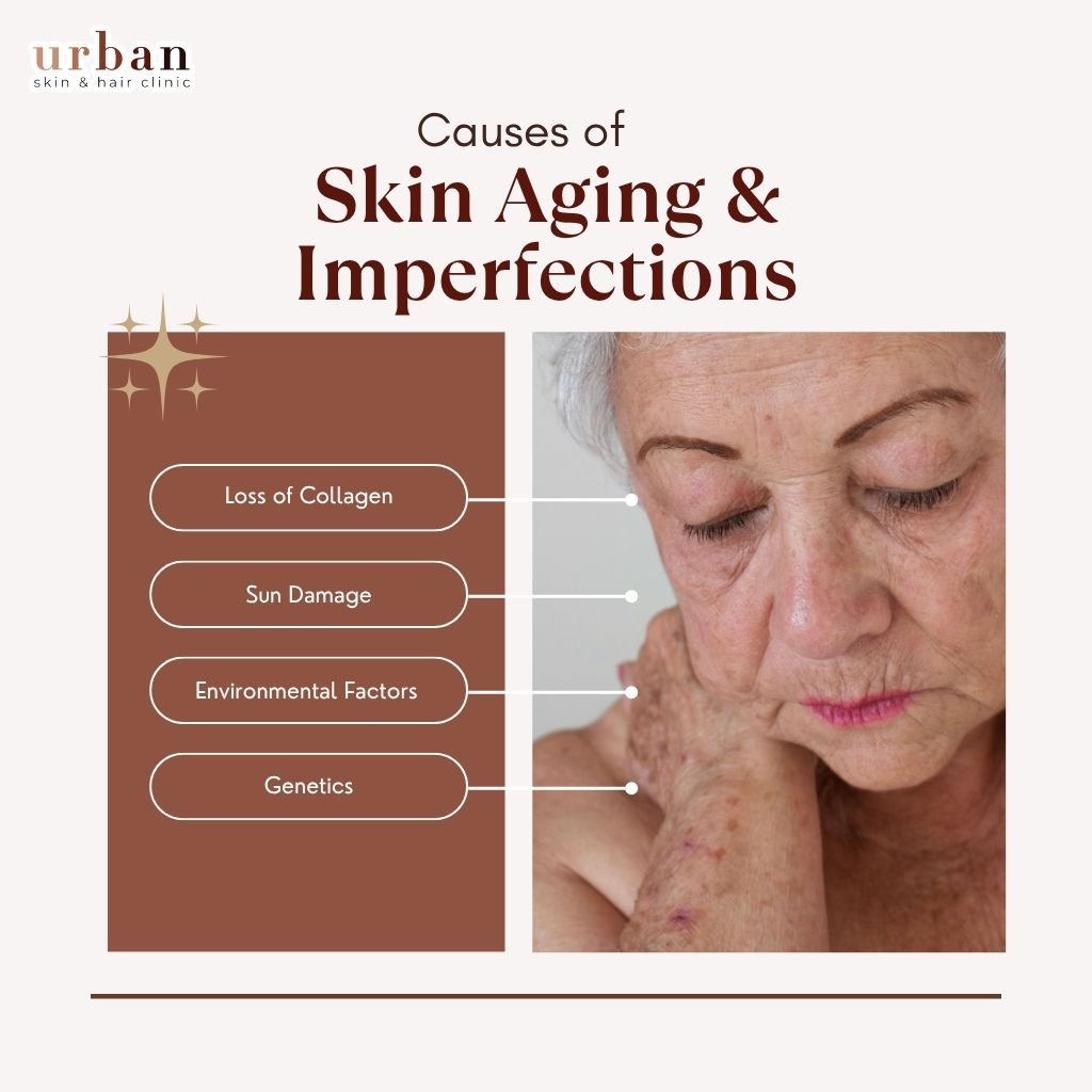 Causes of Skin Aging