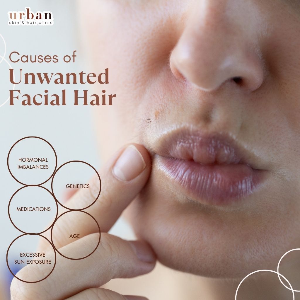 Causes of facial hair