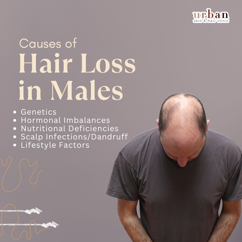 Causes of Male hair loss