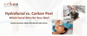 Hydrafacial vs Carbon peel treatment