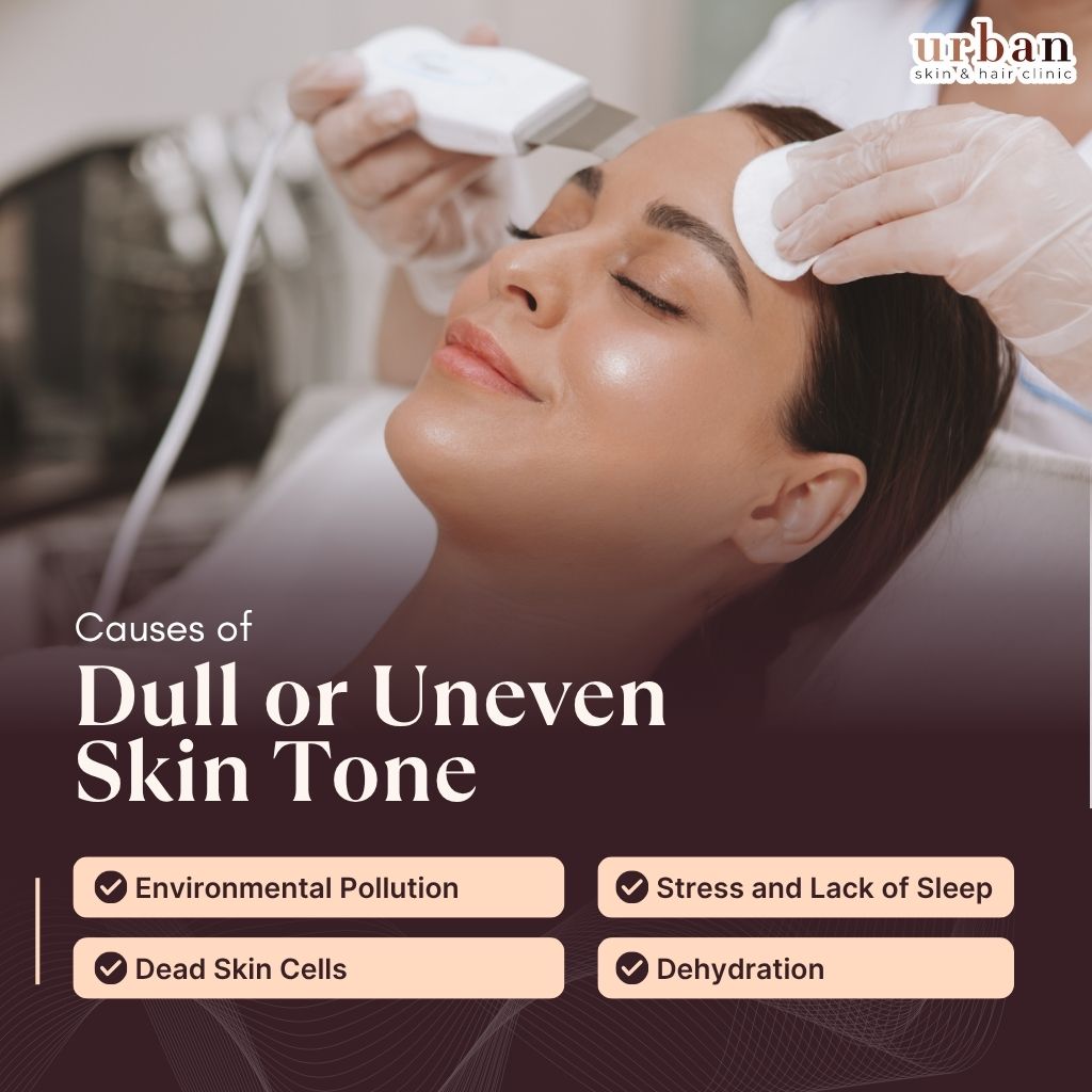 Causes of Dull skin tone