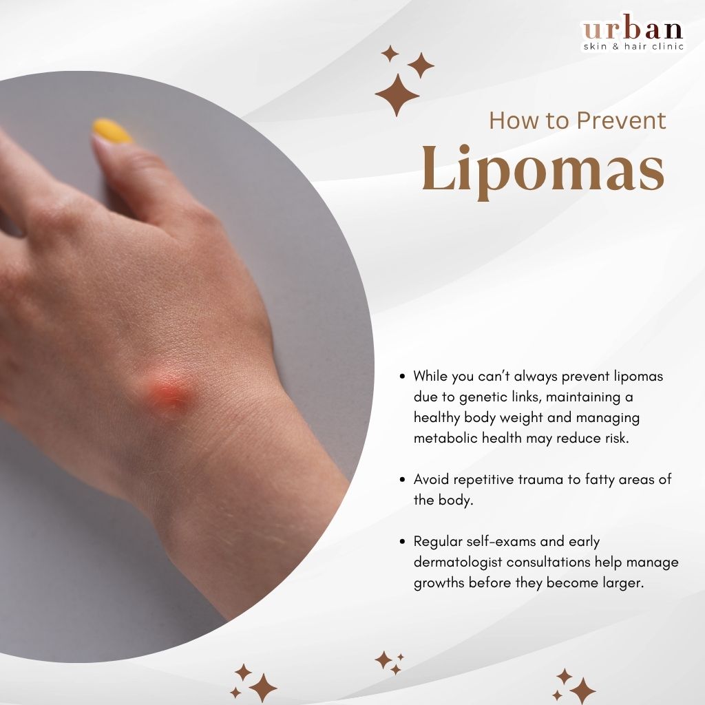How to prevent Lipoma