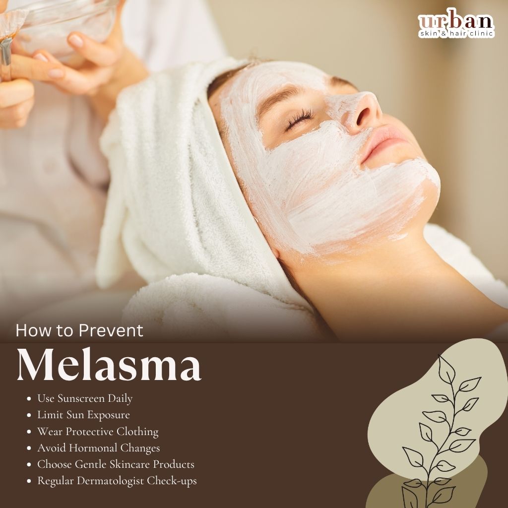 How to prevent Melasma
