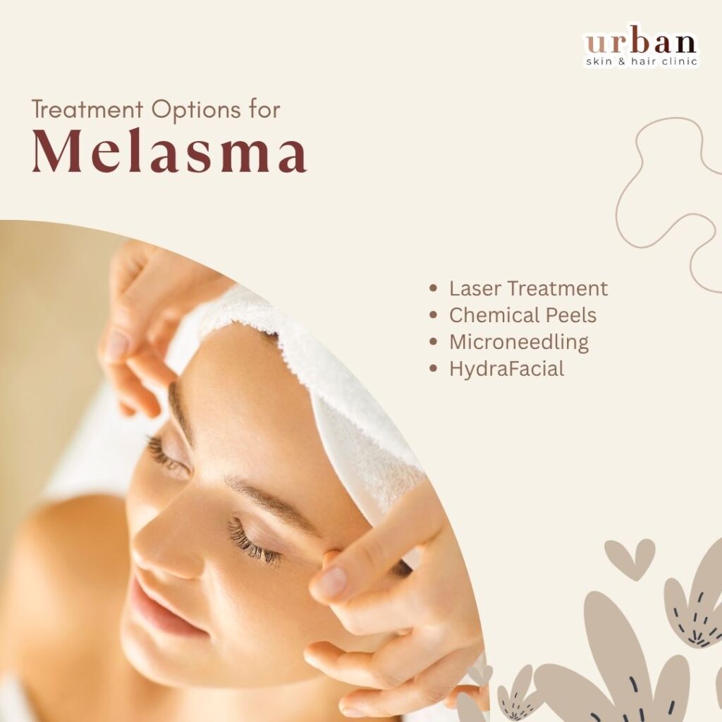 Treatment options for melasma