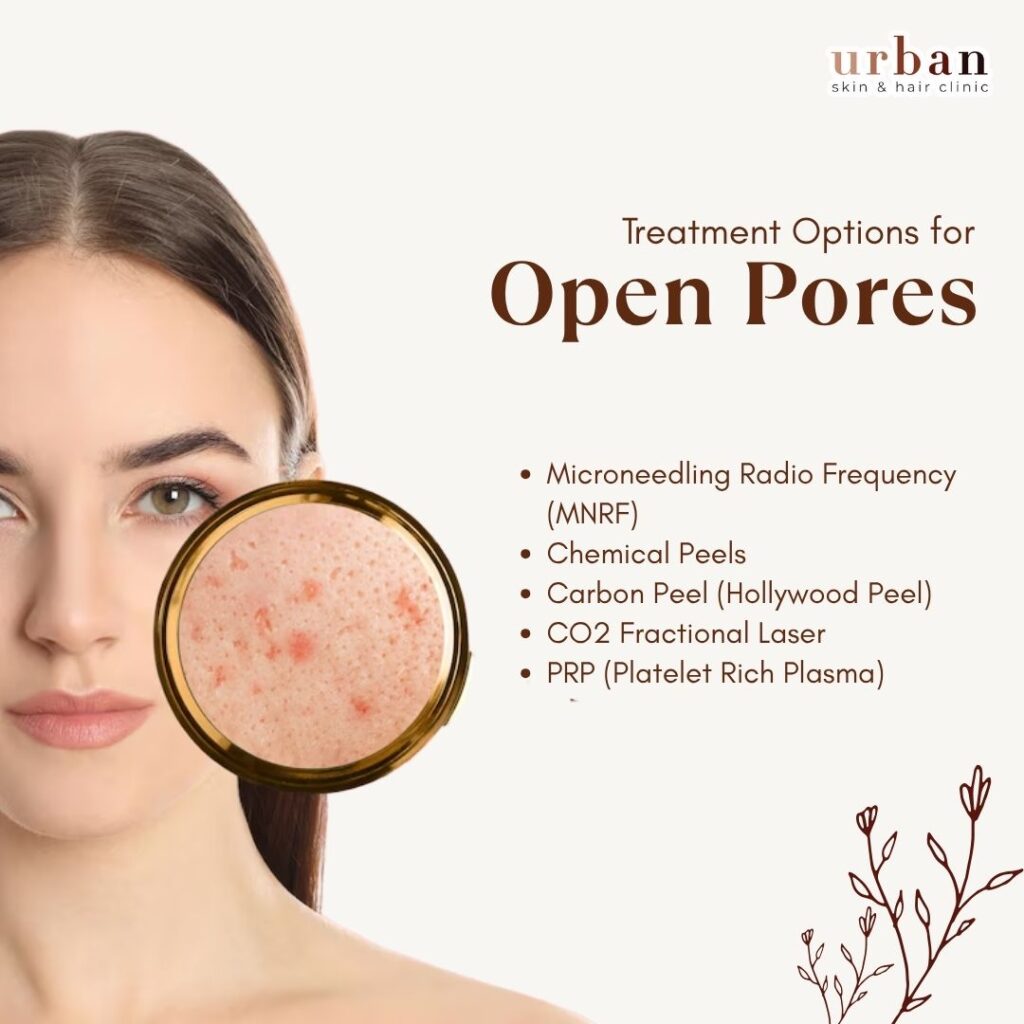 Treatment Options for open pores