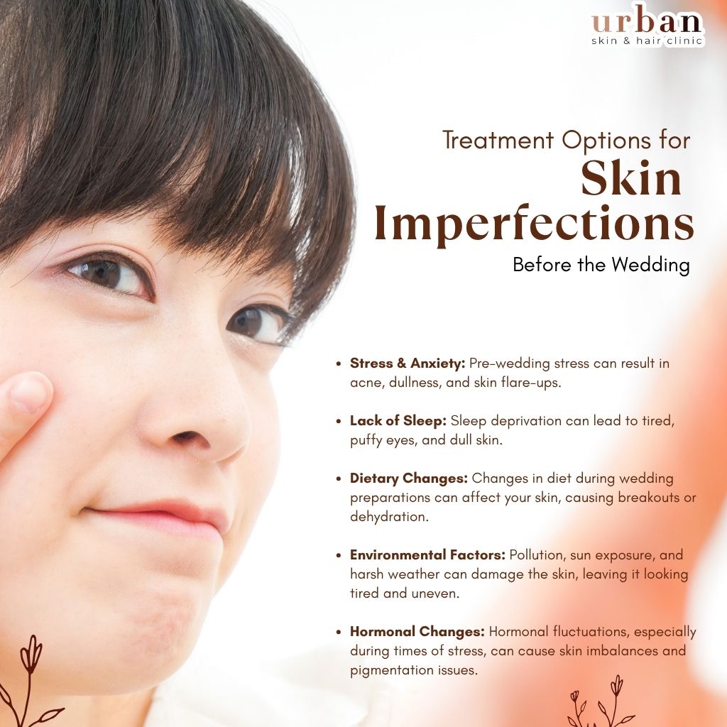 How to Maintain Your Skin Before the Wedding