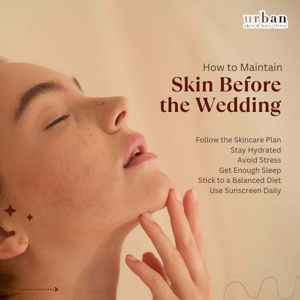 Causes of Skin Imperfections Before the Wedding