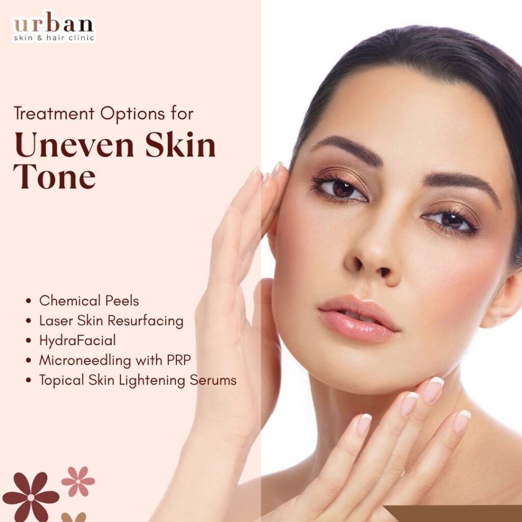 Treatment for Uneven Skin Tone​