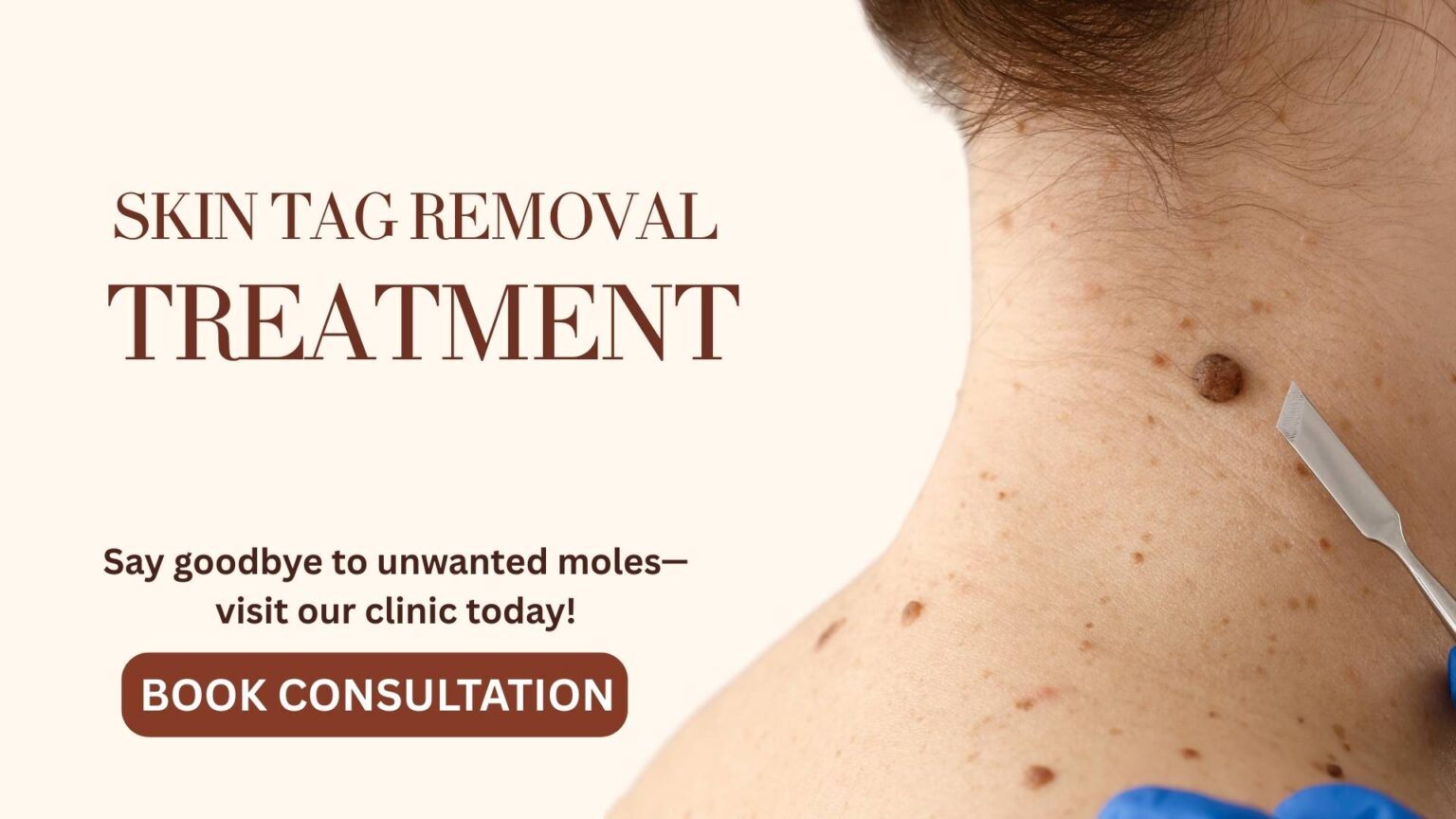 Skin Tag Removal in Pune