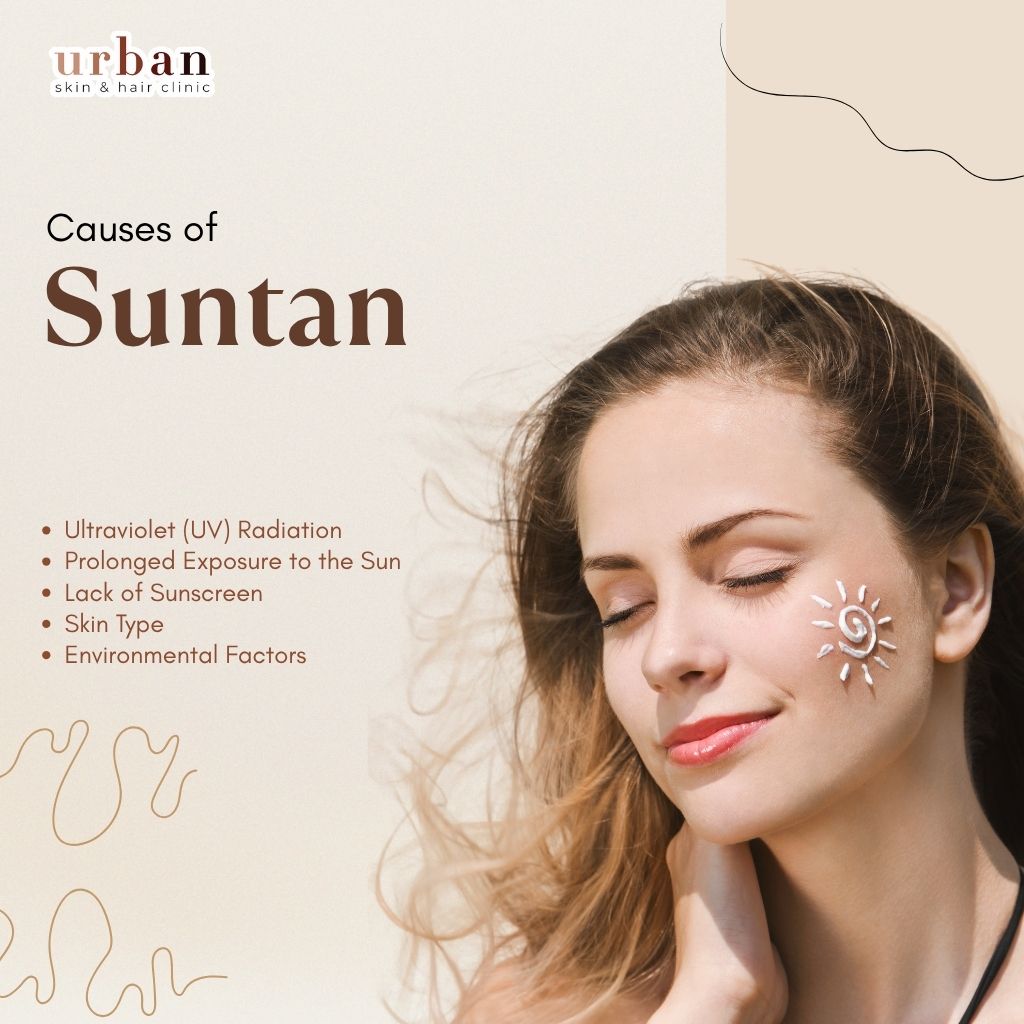 Causes of Suntan