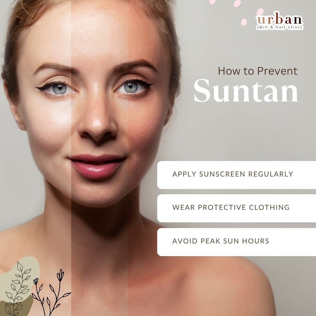 How to prevent suntan