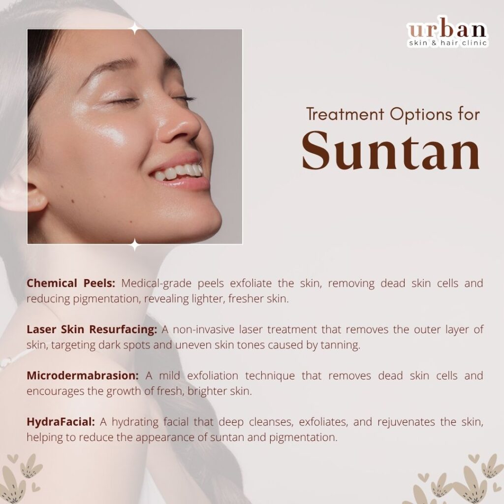 treatment for suntan