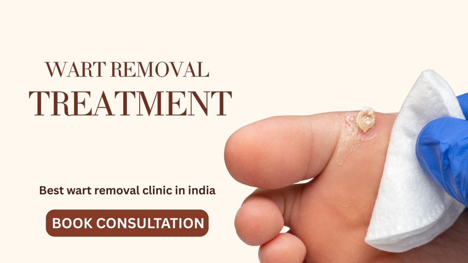 Wart Removal in Pune