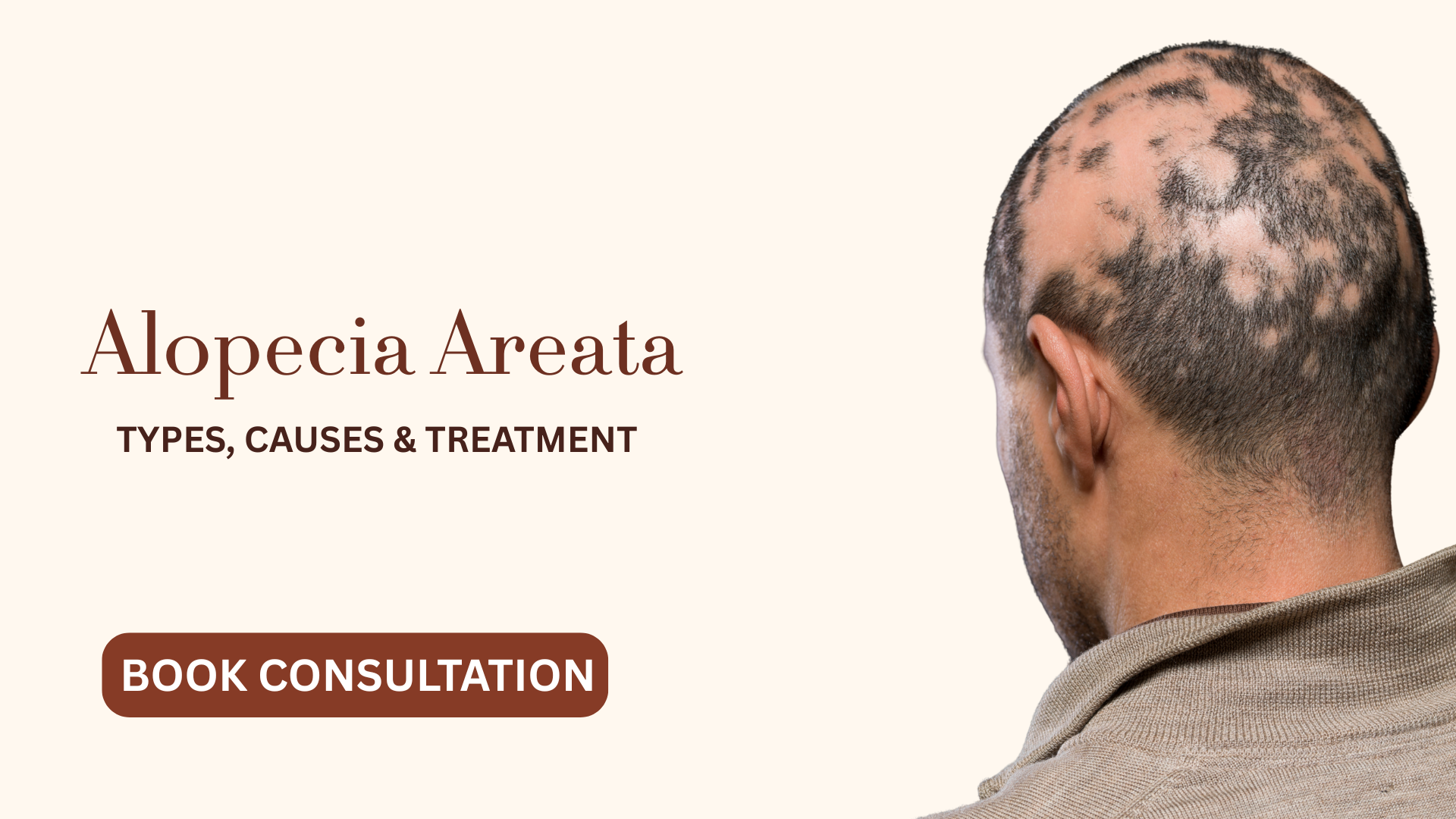 Alopecia areata treatment
