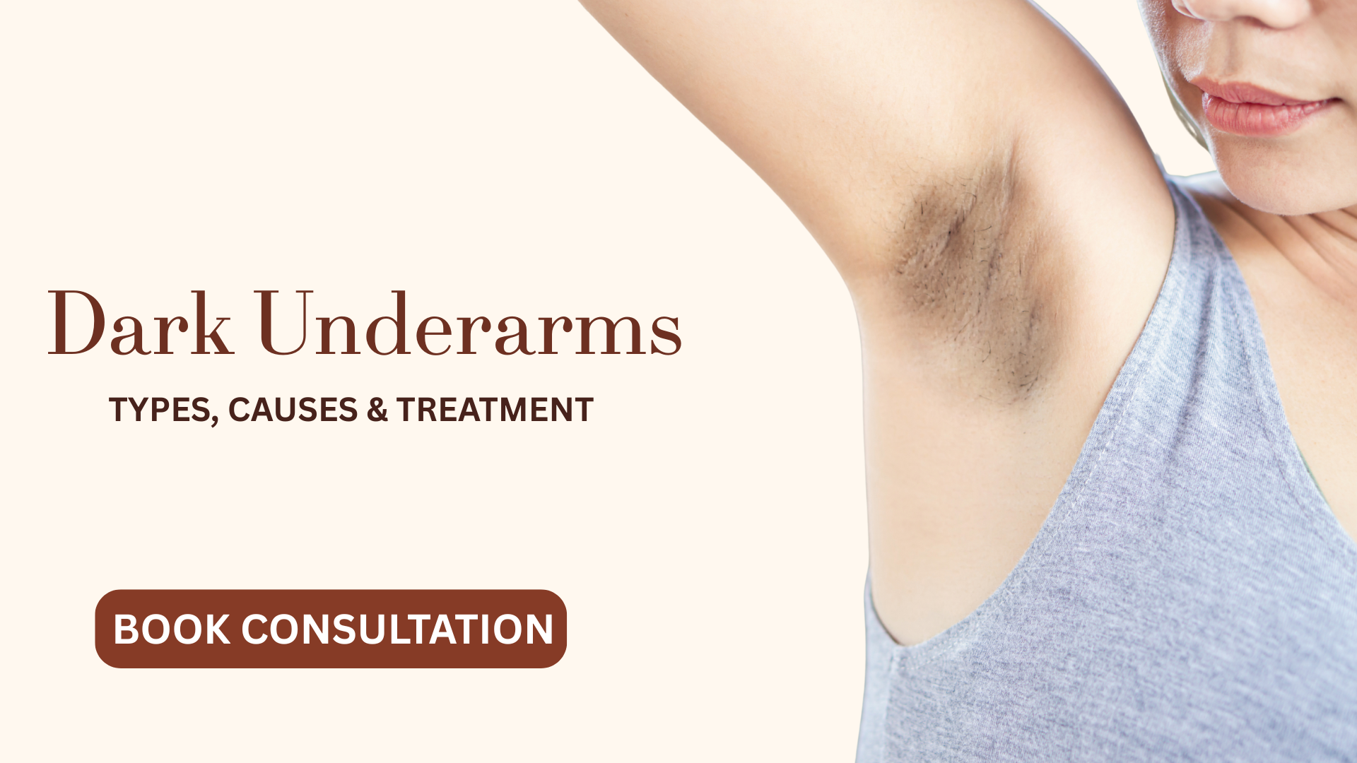 Dark Circles treatment