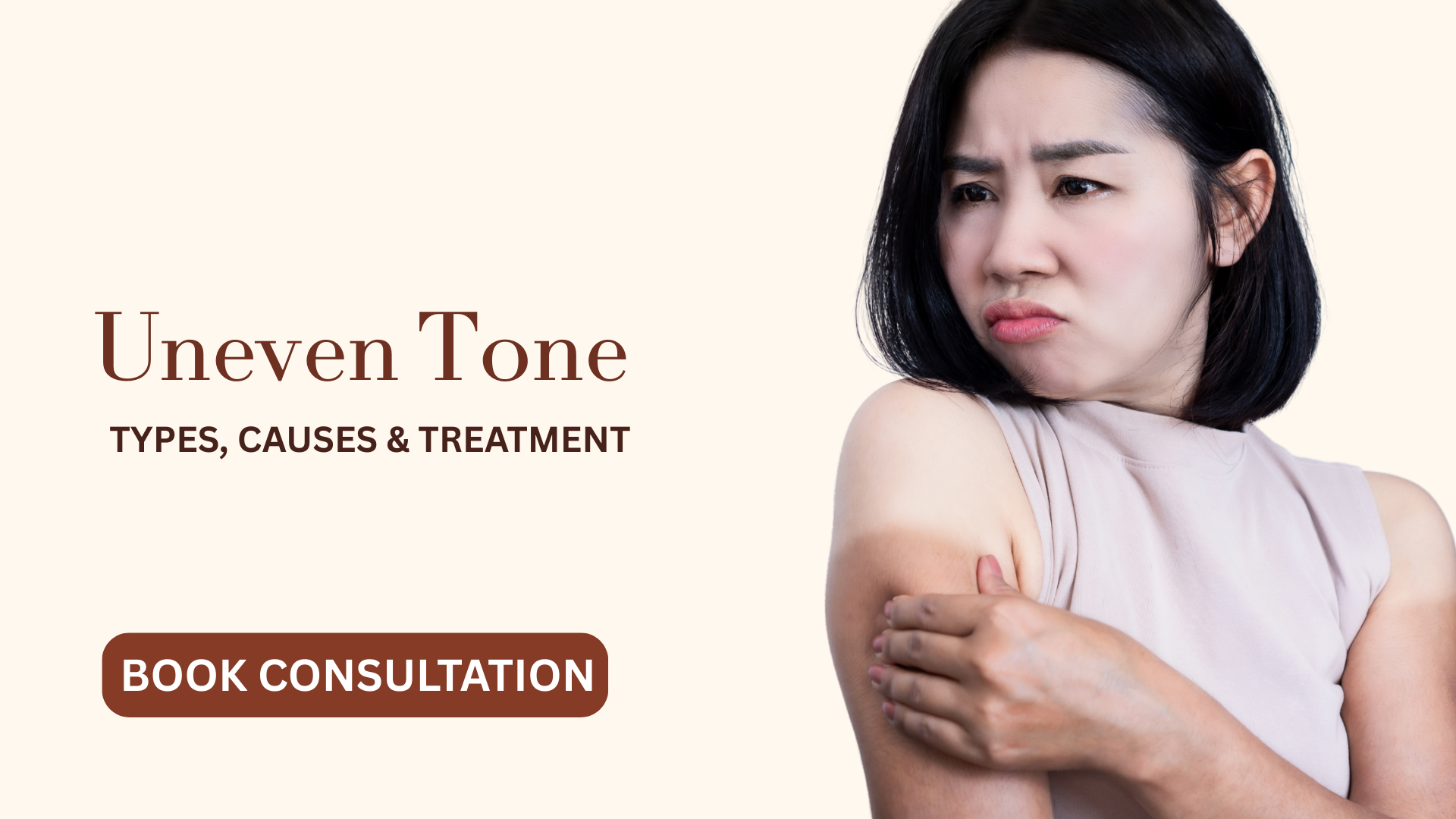 Uneven skin tone