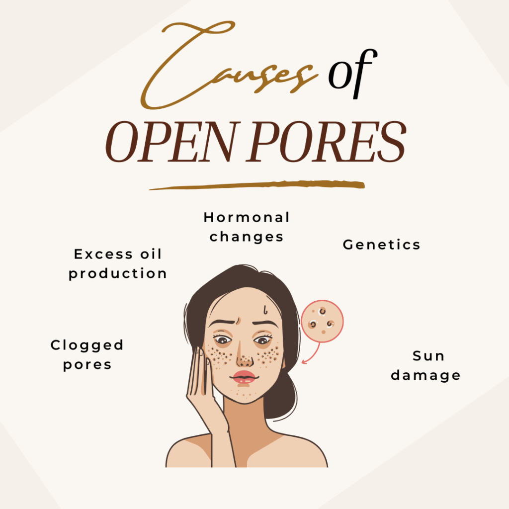 Causes of Open Pores