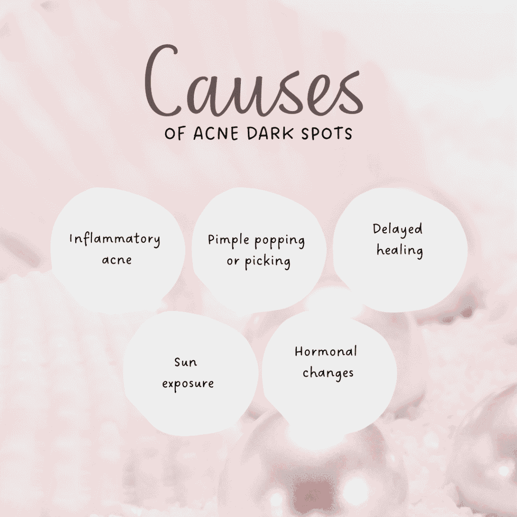 Causes of Acne Dark Spots