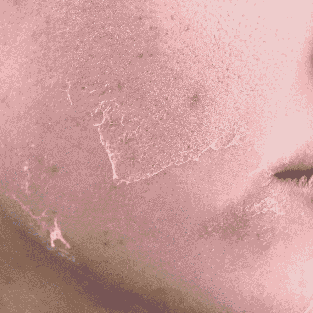 Dull Skin
